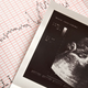 Illustration for article titled The Bogus Debate Used To Push Anti-Abortion Legislation